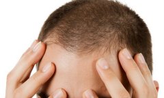 Ученые создали шапку для борьбы с облысением