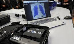 Туркменистан расширил диагностику туберкулеза с помощью ИИ